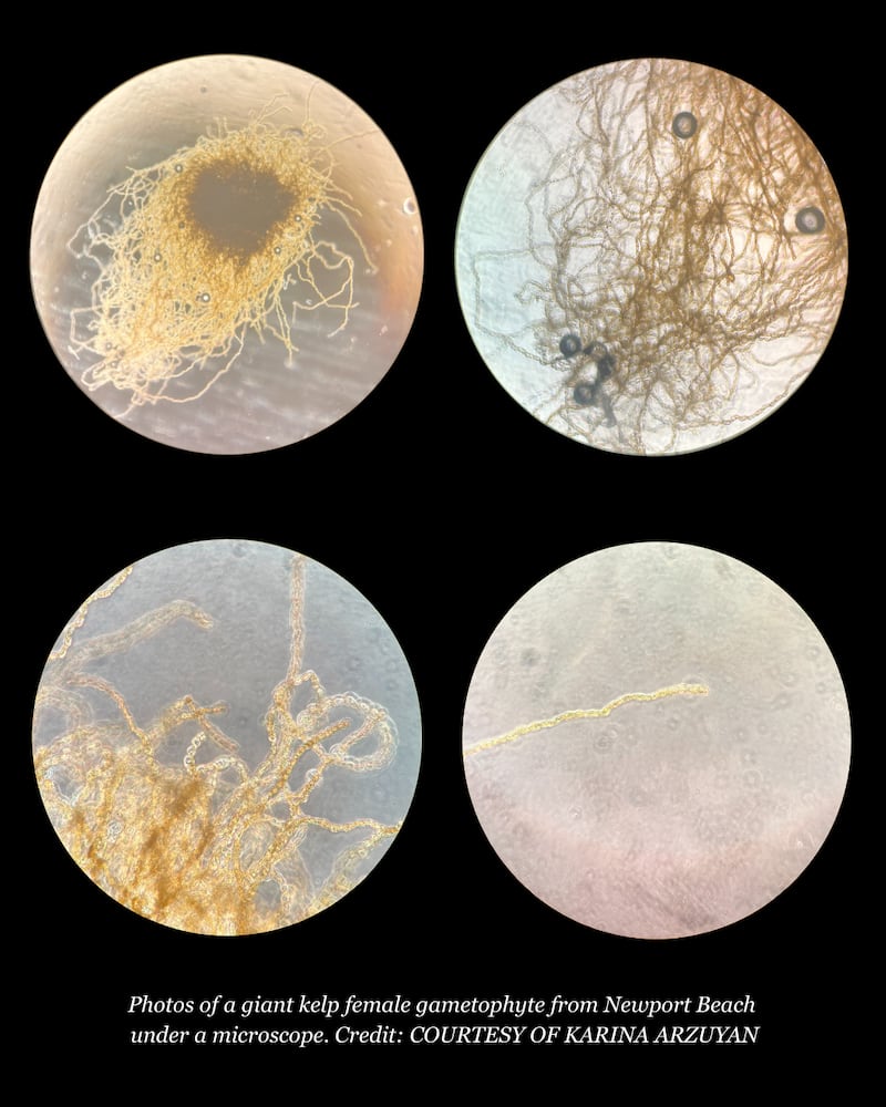 A photo of kelp gametophytes under a microscope.